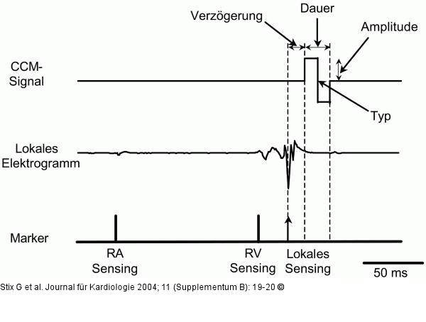 Kardiale Kontraktilittsmodulation