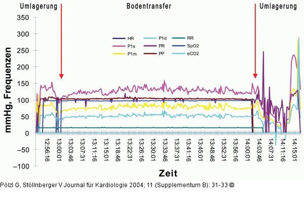 Kardiogener Schock - Vitalparameter
