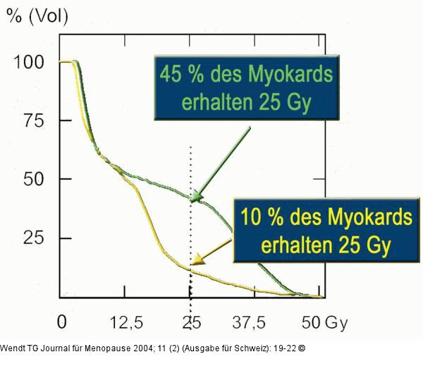 Mammakarzinom - Myokard