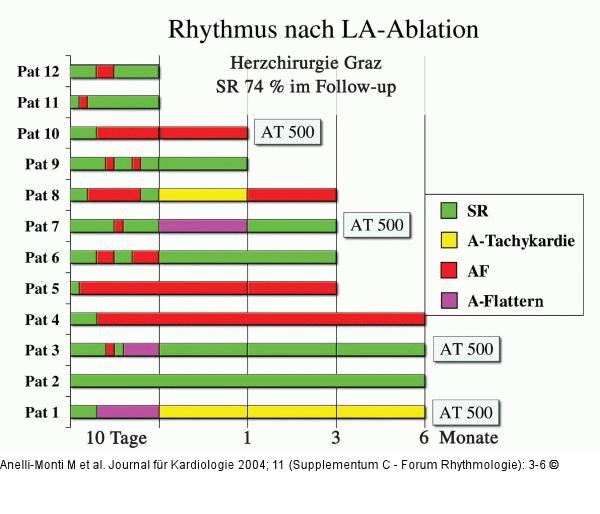 Herzrhythmus - Zeitlicher Verlauf