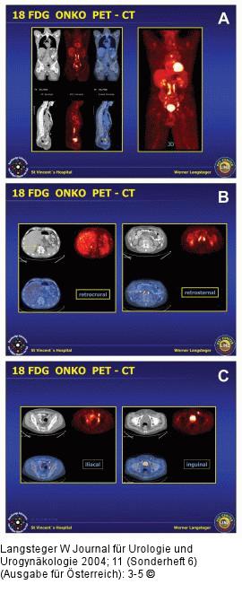 FDG-PET-CT