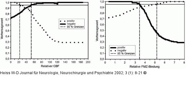 Gehirn - Perfusion