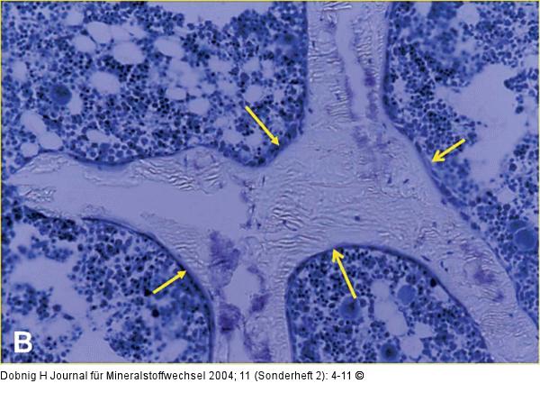 Proximale Tibia
