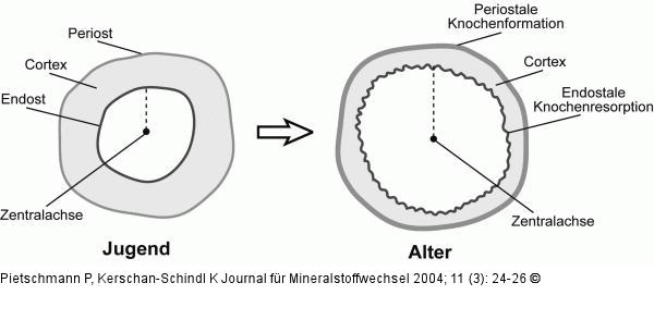 Knochengeometrie - Vernderung