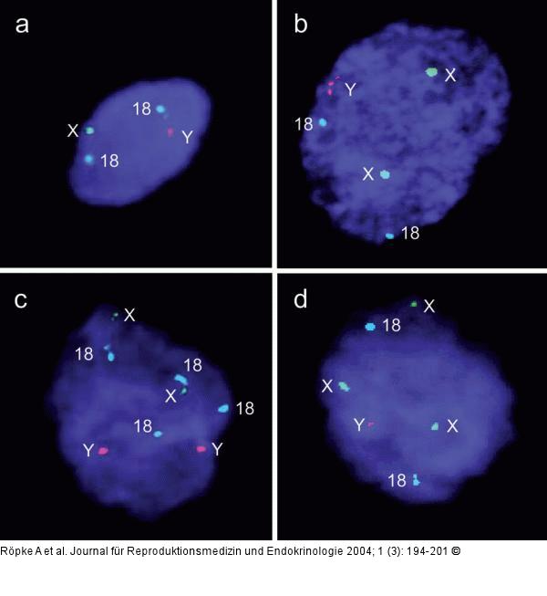 FISH-Analyse - Zentrometer - Chromosom