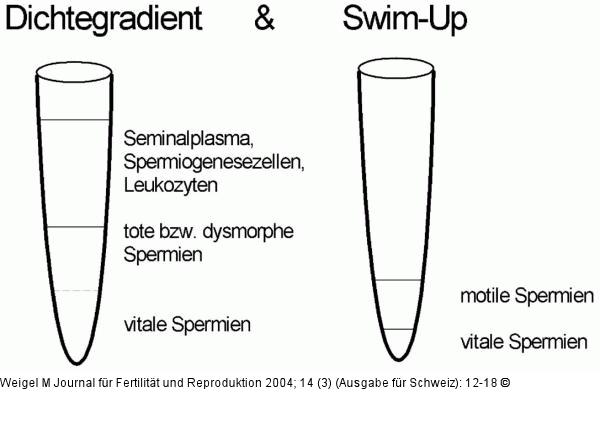 Zweistufige Spermienaufbereitung