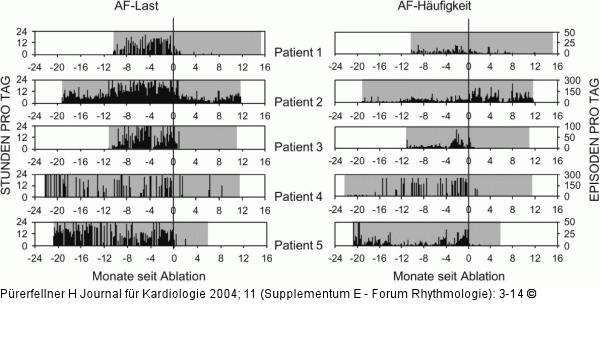 Arrhythmie-Last - Arrhythmie-Hufigkeit