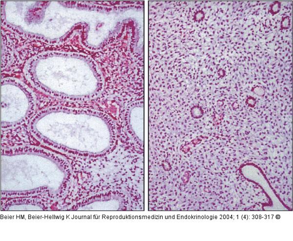 Endometrium - Histologie