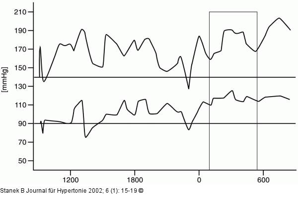 Hypertonie nach Herztransplantation