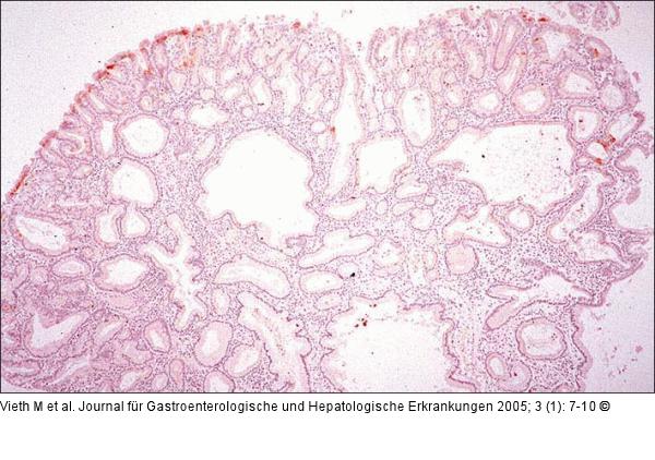 PGA - Apumucin 5AC