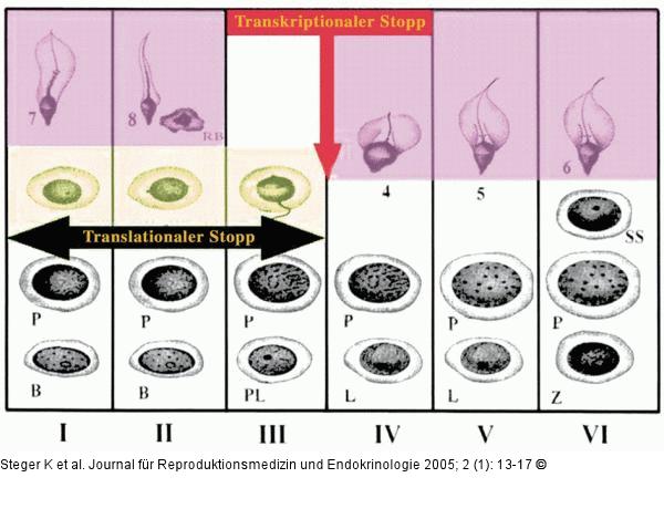 Spermatogonien - Spermatide2