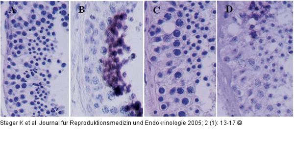 Spermatogenese