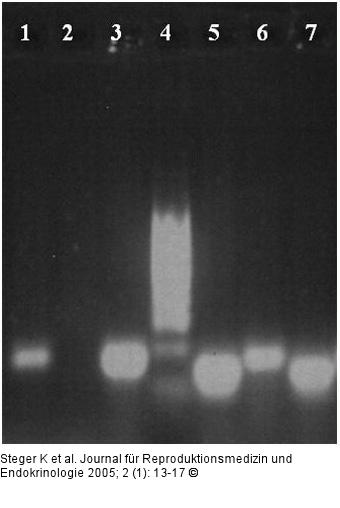 RT-PCR - Protamin 1