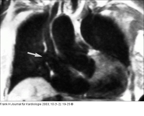 Cardiac Magnetic Resonance Imaging