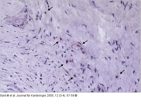 Immunhistochemie/Endomyokardbiopsie