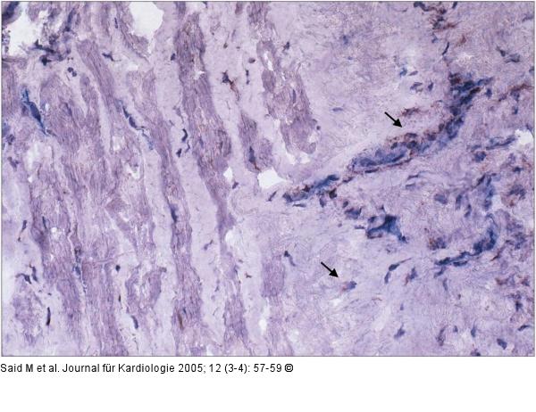 Immunhistochemie/Endomyokardbiopsie