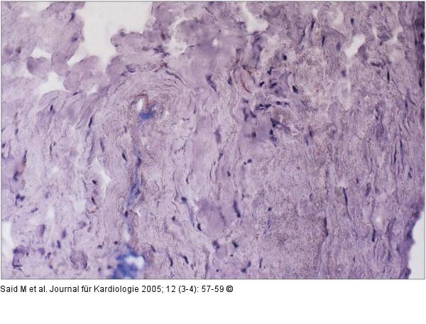 Immunhistochemie/Endomyokardbiopsie