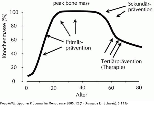 Osteoporose - Prvention - Therapie