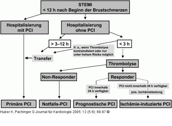 STEMI