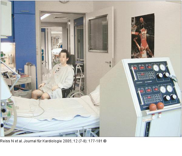 Biventrikulres Untersttzungssystem