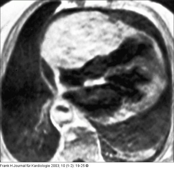 Cardiac Magnetic Resonance Imaging