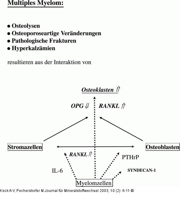 Knochen - multiples Myelom