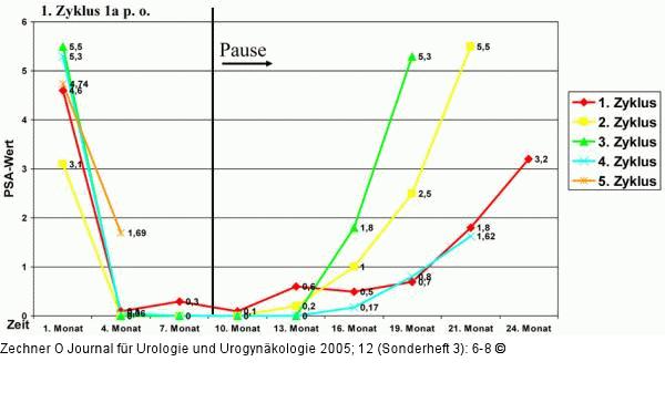Prostatakarzinom - Intermittierende Therapie