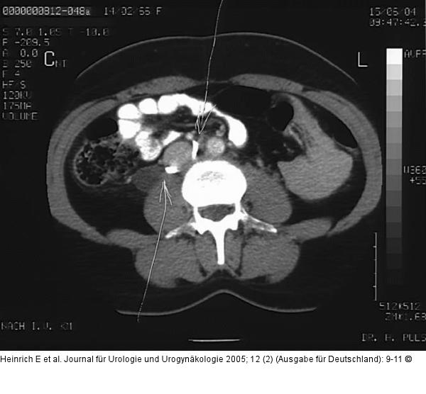 CT-Abdomen