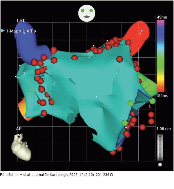Elektroanatomisches Mapping