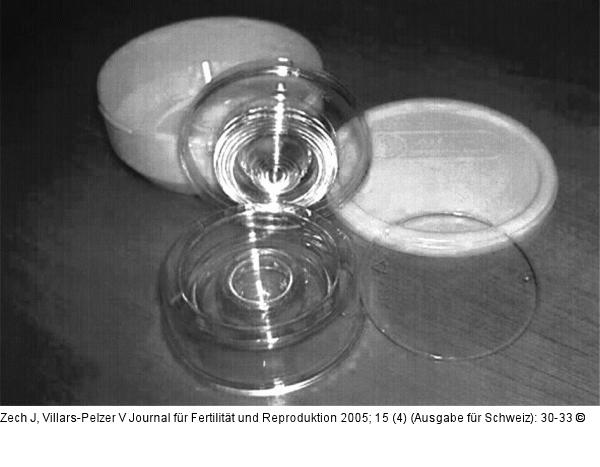 Zech-Selector(R)