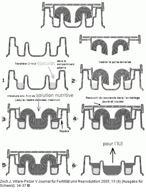 Zech-Selector(R)