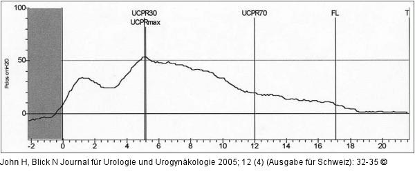 Postoperatives Urethradruckprofil