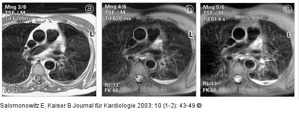 Kardiale Magnetresonanztomographie