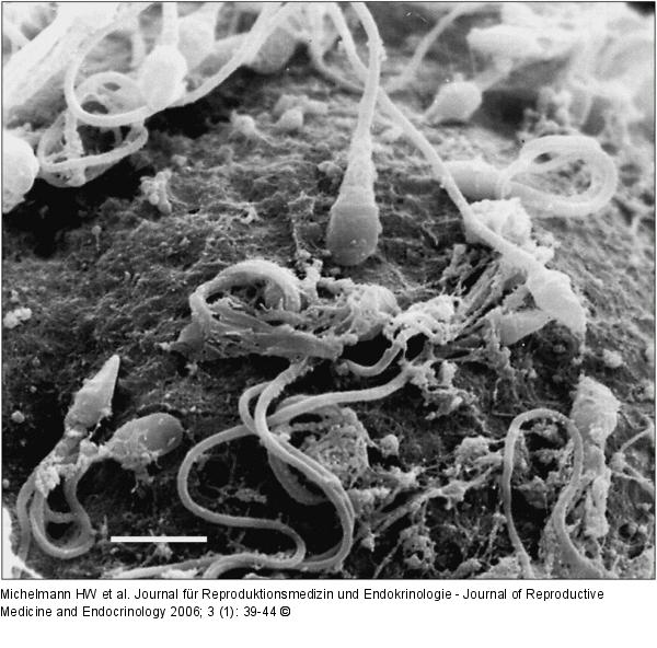 Spermatozoon - Akrosomenkappe