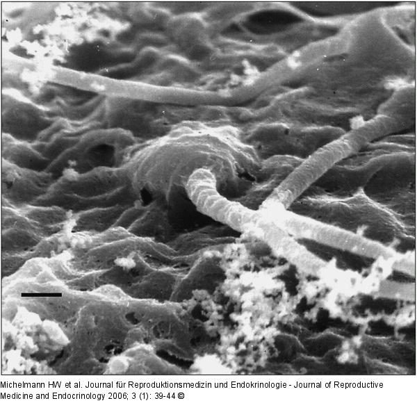 Spermatozoon - Zona pellucida
