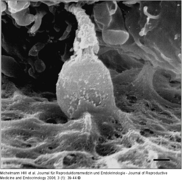 Spermatozoon - Zona pellucida