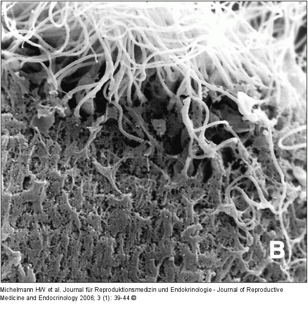Spermatozoon