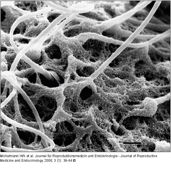 Spermatozoon - Zona pellucida