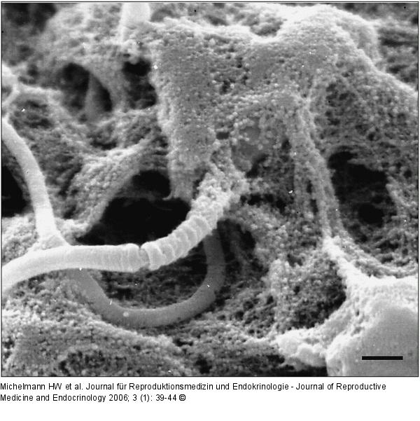 Spermatozoon - Zona pellucida