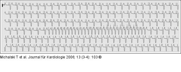 Gesamt-EKG-Verlauf