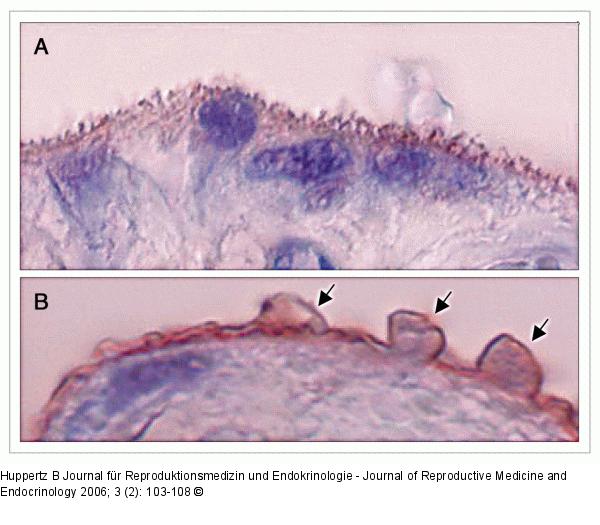 Term placentas