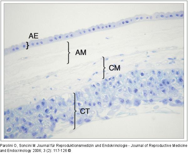 Human term placenta