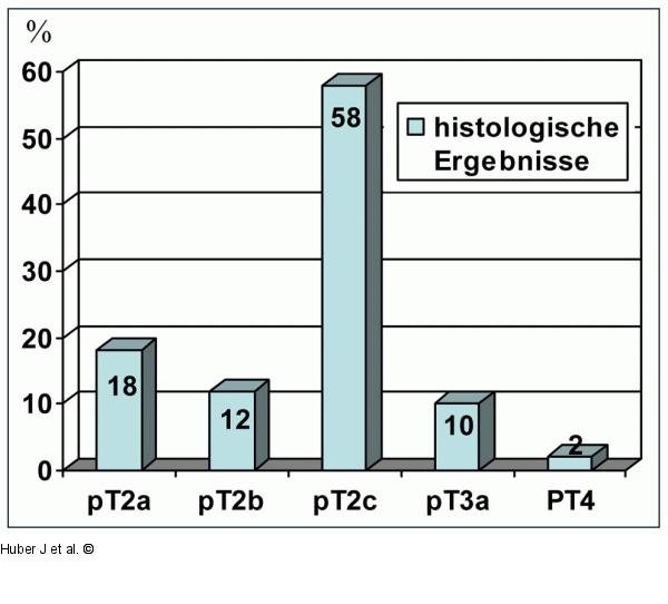 Prostatektomie - Histologie
