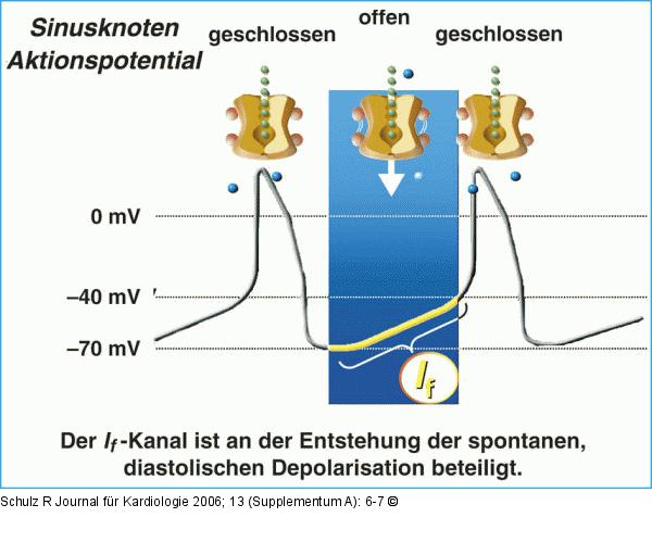 If-Kanal