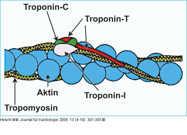 Troponin-Komplex