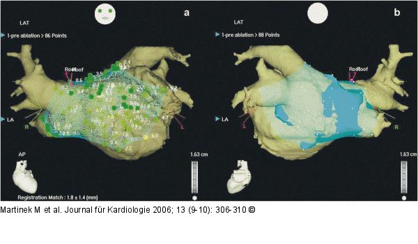 CT-Bild - CartoMergeTM-Map