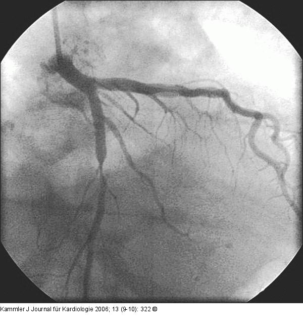 Angiogramm