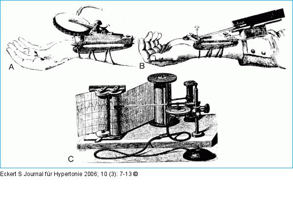 Sphygmograph