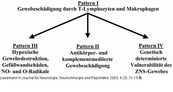 Multiple Sklerose - Gewebeschdigung