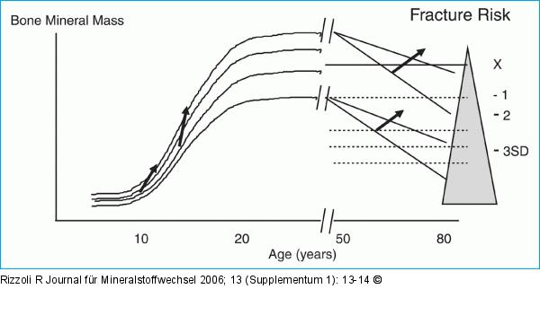 Fracture - Aging
